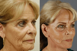 Best Make Over Cosmetic Surgery surgeons