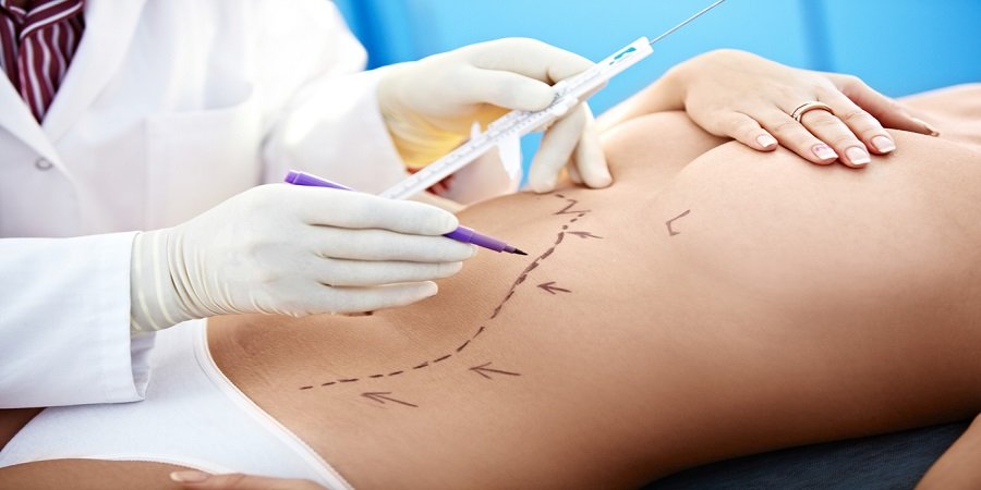 Liposuction surgery in Jeddah