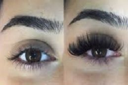 Eyelash hair Transplant in Riyadh & Saudi Arabia