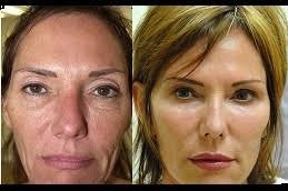 cosmetic surgery in Riyadh & Saudi Arabia