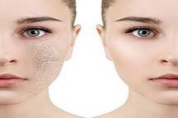 Dry Skin Treatment in Riyadh & Saudi Arabia