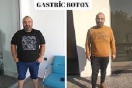 Gastric Botox in Riyadh and Saudi Arabia