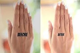 Tan removal in Riyadh & Saudi Arabia