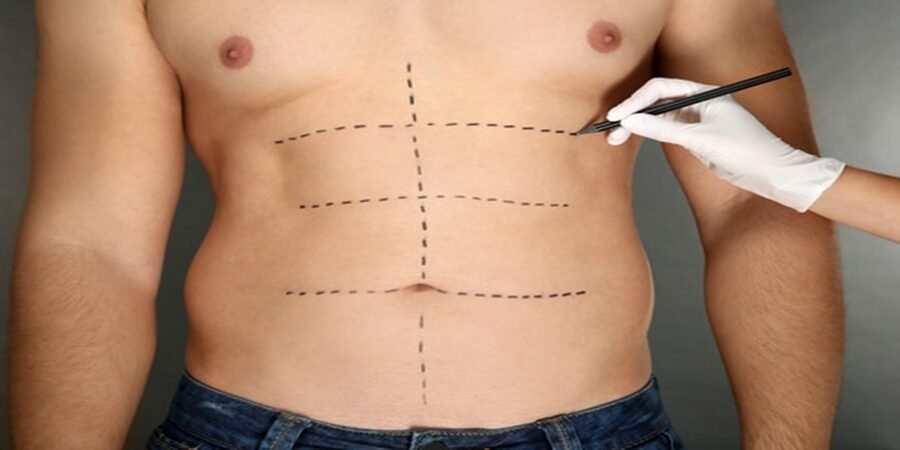 360 Liposuction in Riyadh