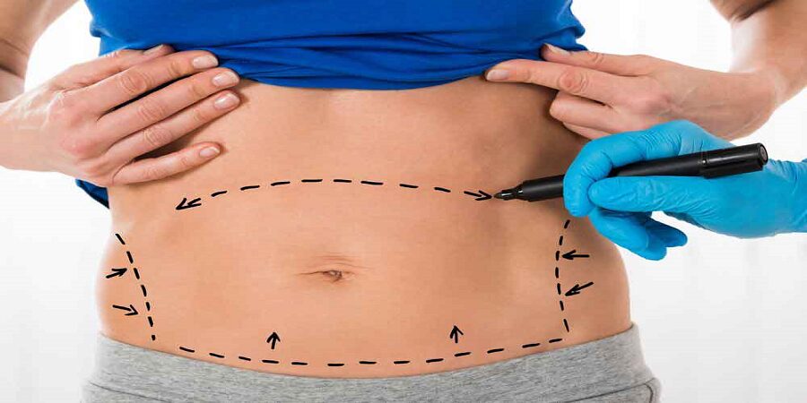 How does liposuction works