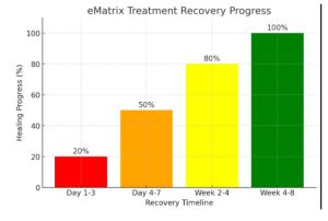 eMatrix Chart