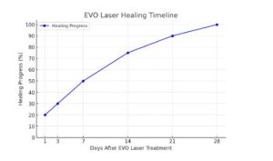 Evo Laser Chart