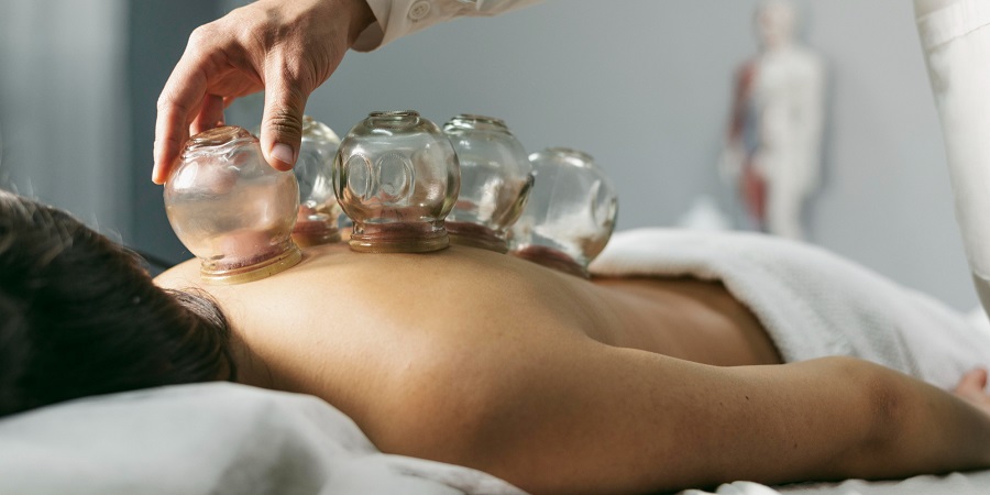 Hijama Treatment in Riyadh